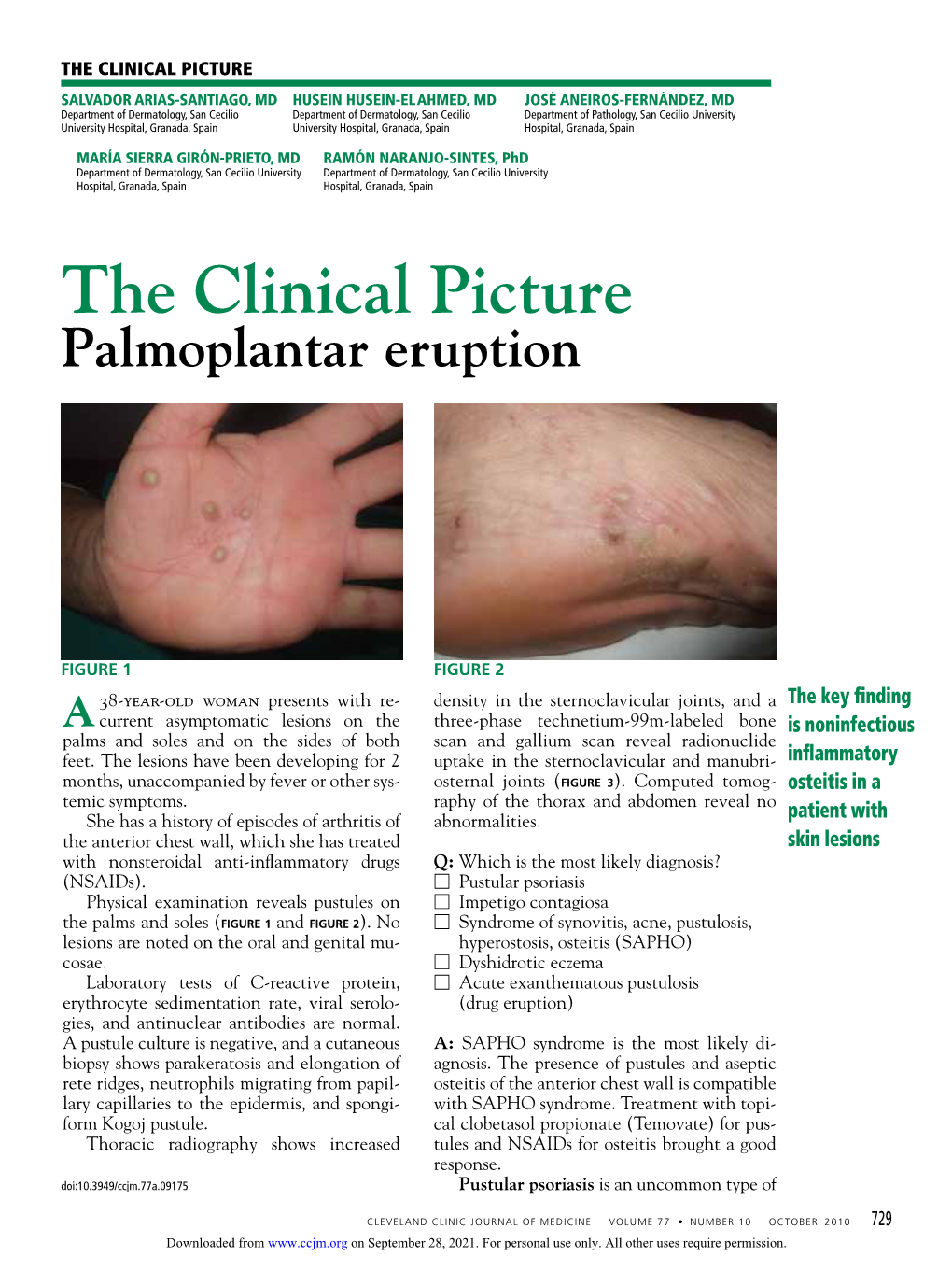 Palmoplantar Eruption