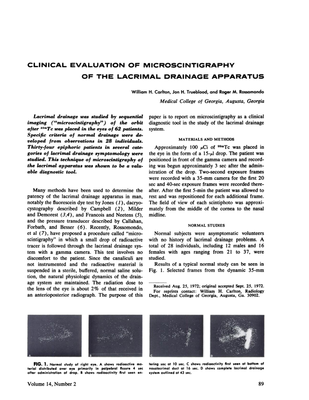 Clinical Evaluation of Microscintigraphy of the Lacrimal Drainage Apparatus