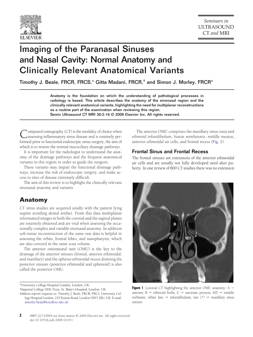 imaging-of-the-paranasal-sinuses-and-nasal-cavity-normal-anatomy-and