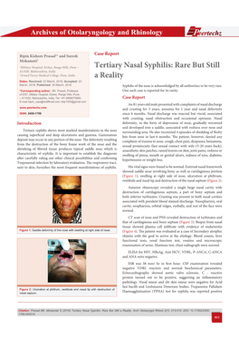 Tertiary Nasal Syphilis