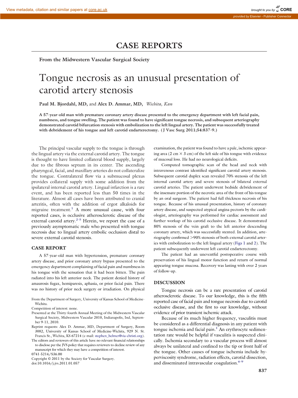 Tongue Necrosis As an Unusual Presentation of Carotid Artery Stenosis