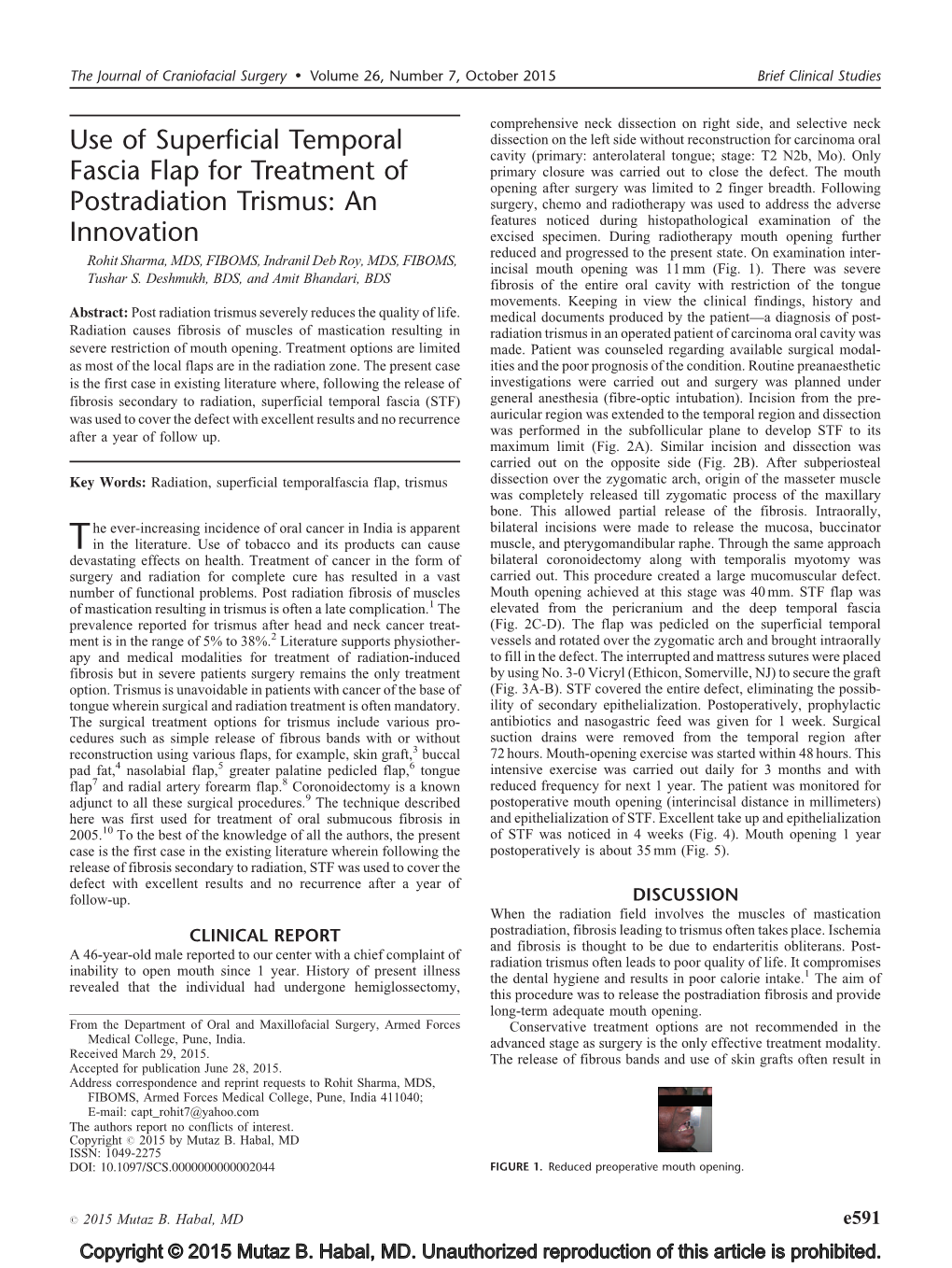 Use of Superficial Temporal Fascia Flap for Treatment of Postradiation