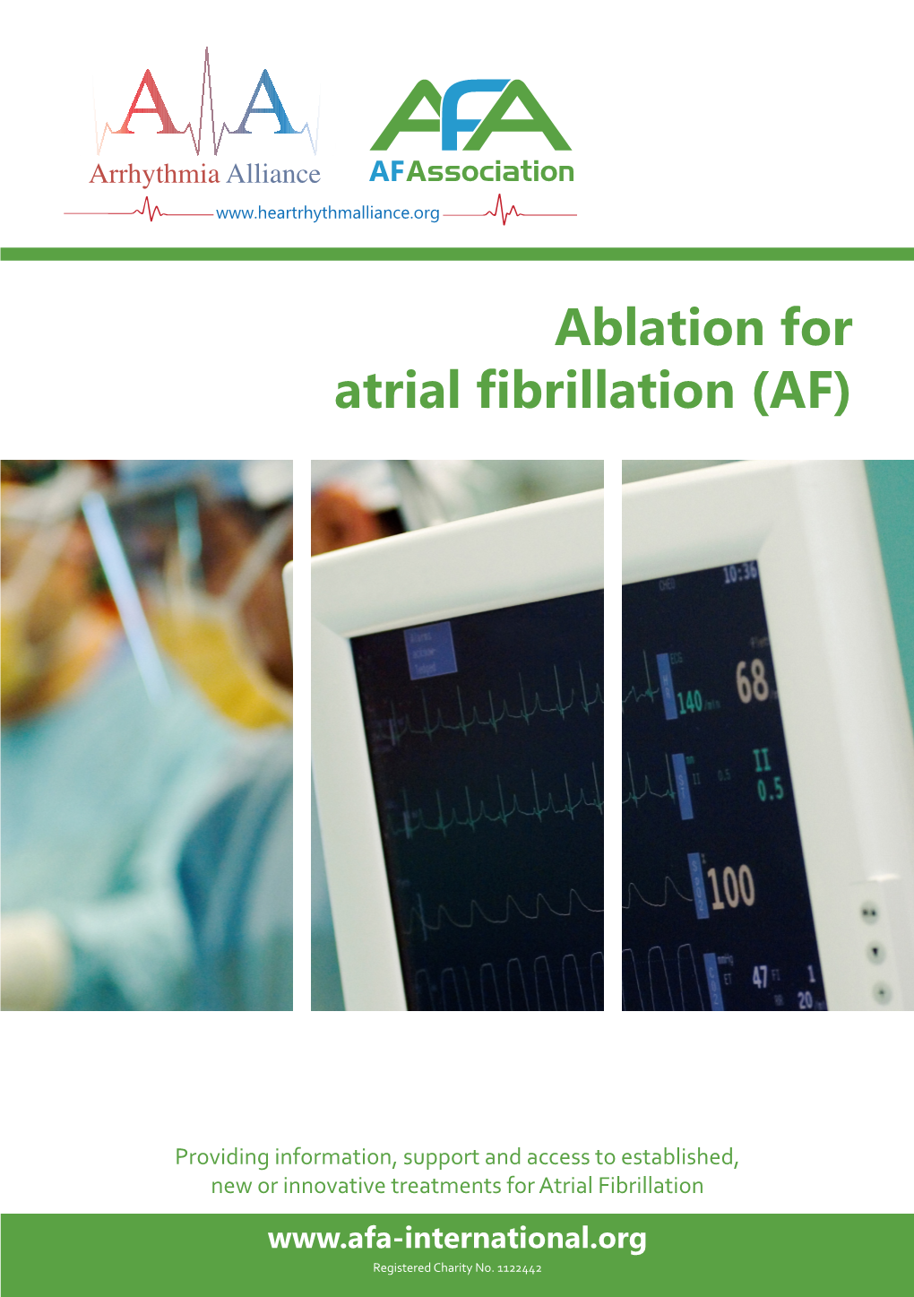 Ablation for AF? AF Using Heat Energy