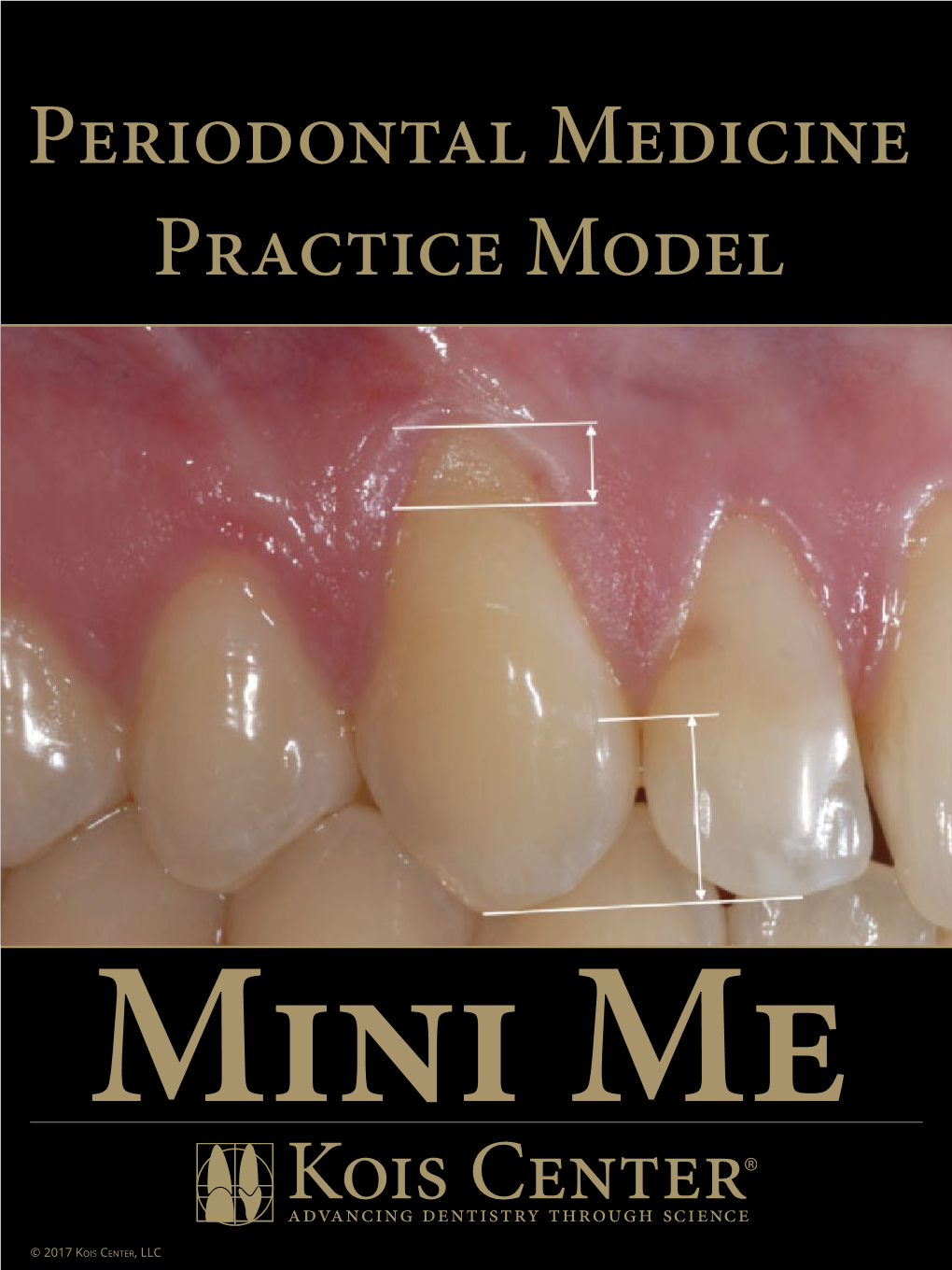 Periodontal Medicine Practice Model Mini Me