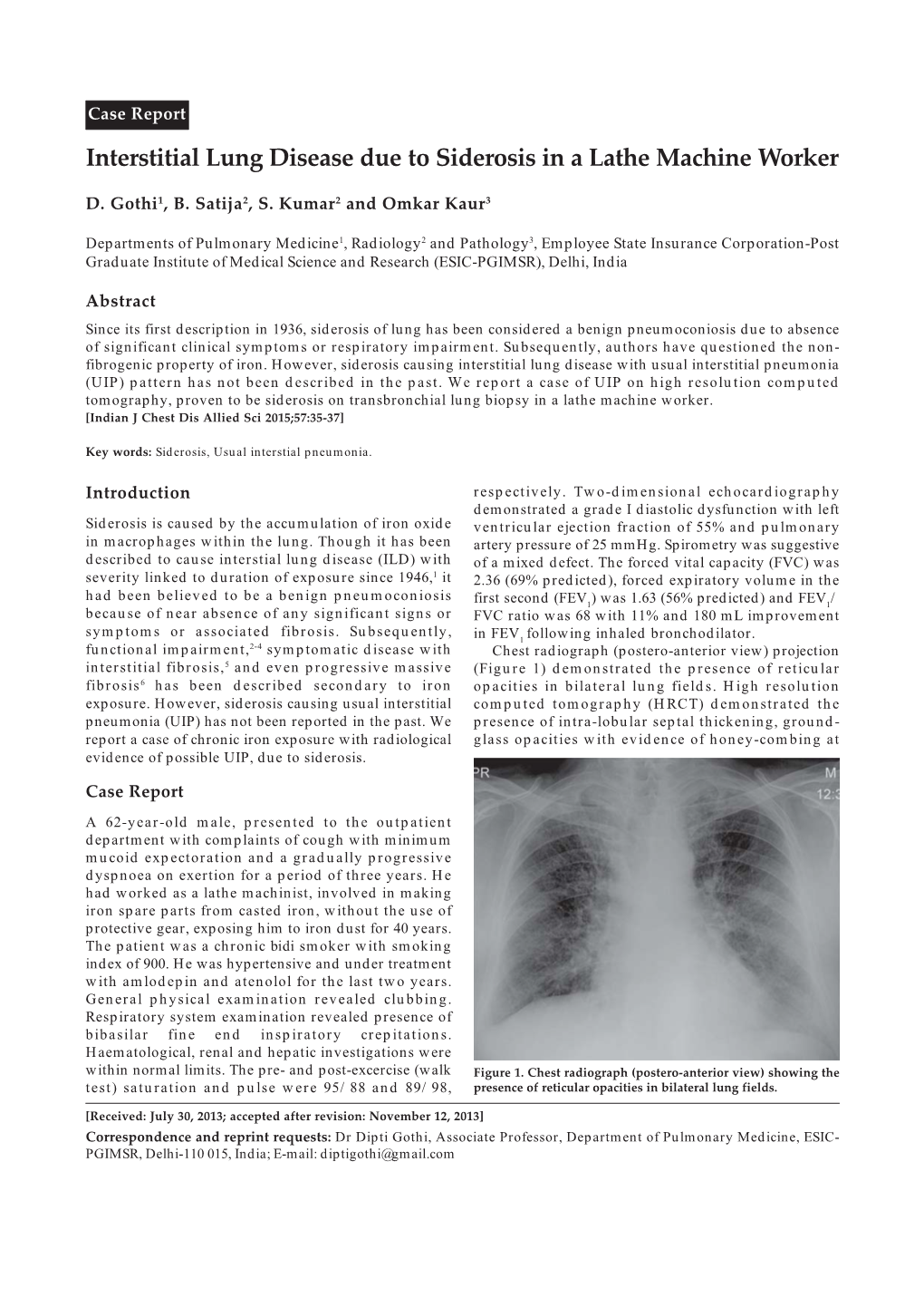 Interstitial Lung Disease Due to Siderosis in a Lathe Machine Worker