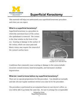 Superficial Keractomy