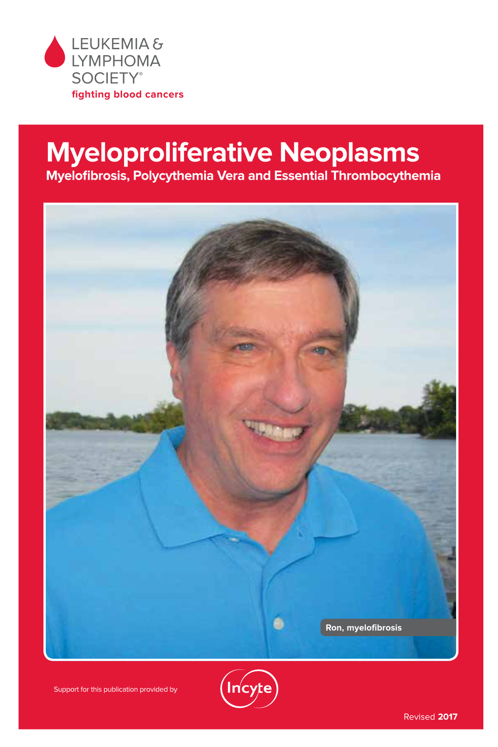 Myeloproliferative Neoplasms Myelofibrosis, Polycythemia Vera and Essential Thrombocythemia