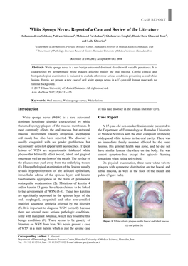 White Sponge Nevus: Report of a Case and Review of the Literature