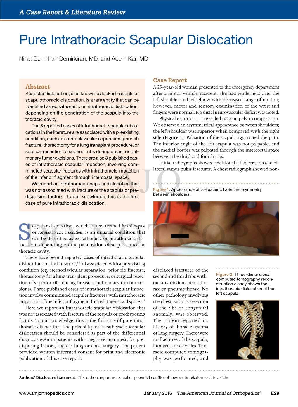 Pure Intrathoracic Scapular Dislocation