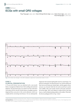 Ecgs with Small QRS Voltages