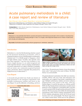 Acute Pulmonary Melioidosis in a Child: a Case Report and Review of Literature
