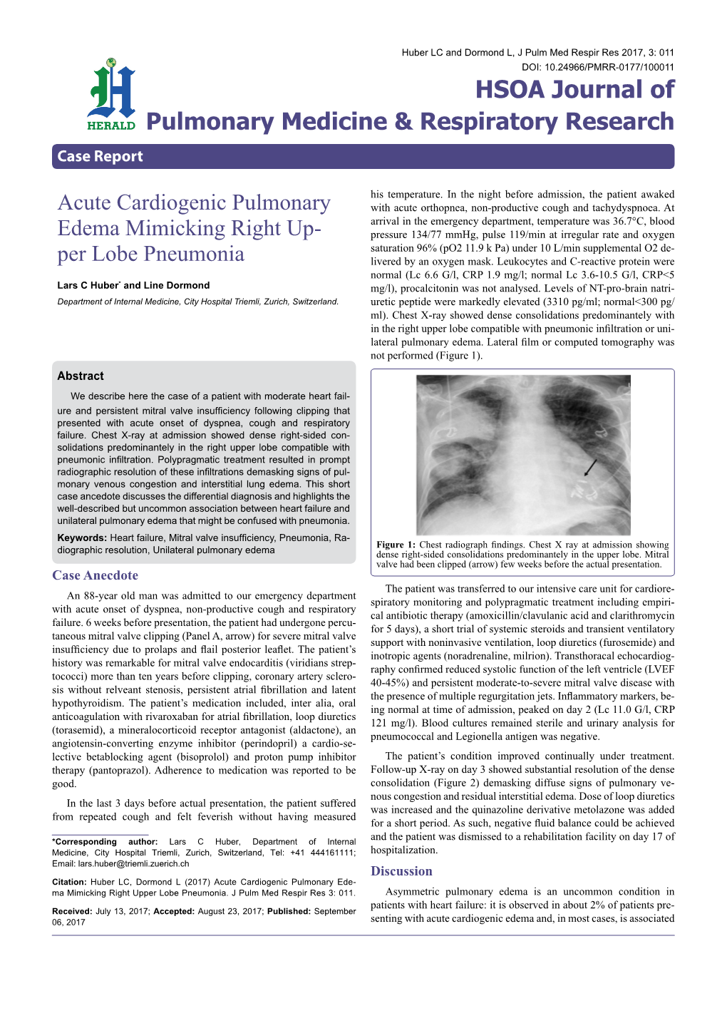 Acute Cardiogenic Pulmonary Edema Mimicking Right Up- Per Lobe