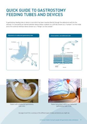 Quick Guide to Gastrostomy Feeding Tubes and Devices