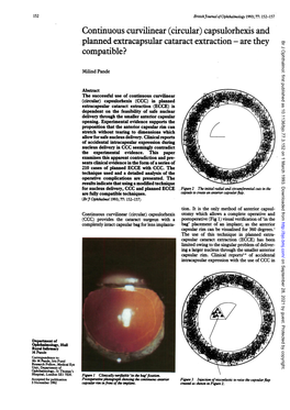 Continuous Curvilinear (Circular) Capsulorhexis and Planned Extracapsular Cataract Extraction