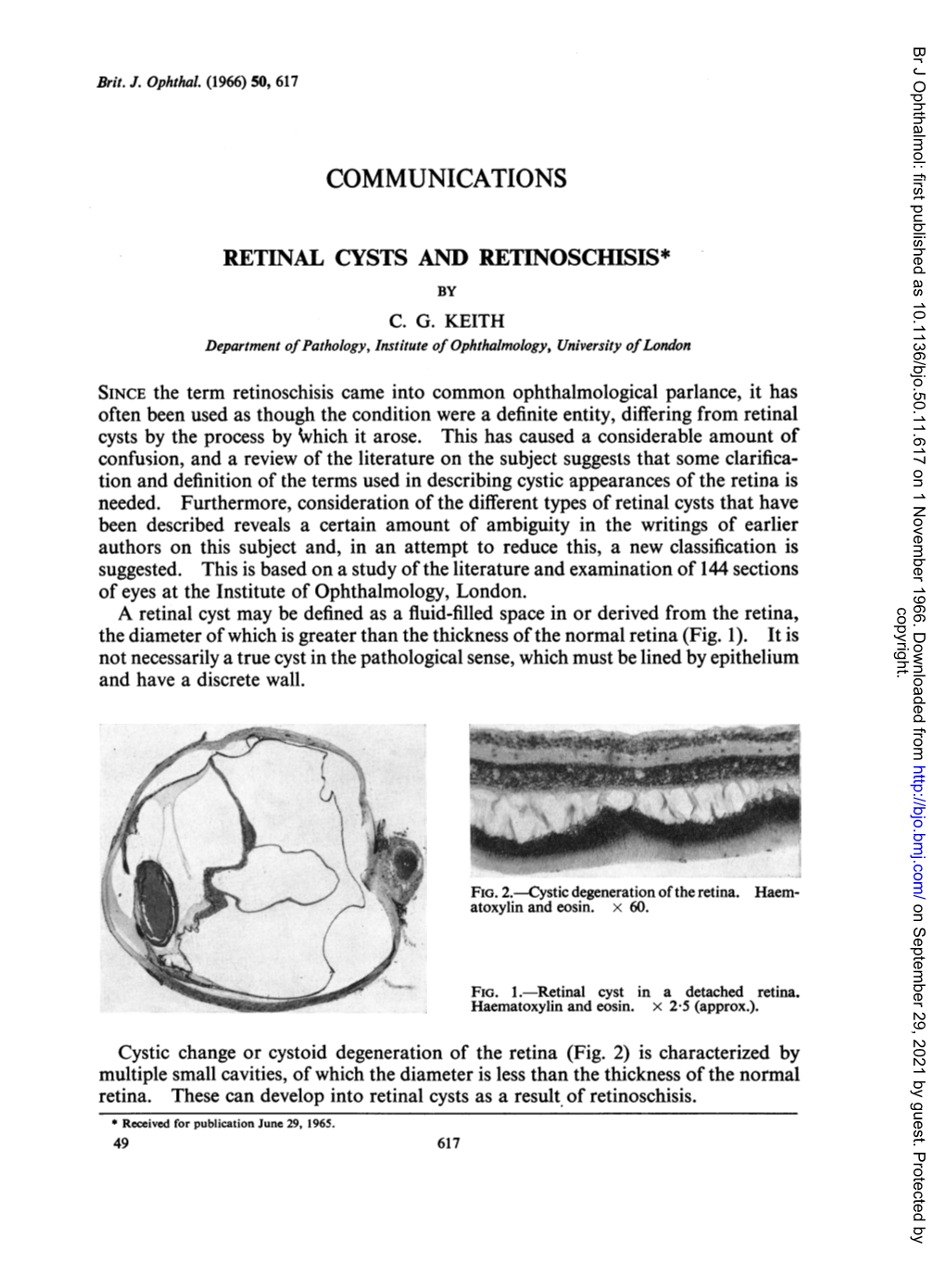 Retinal Cysts and Retinoschisis