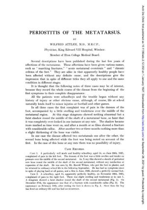 Periostitis of the Metatarsus