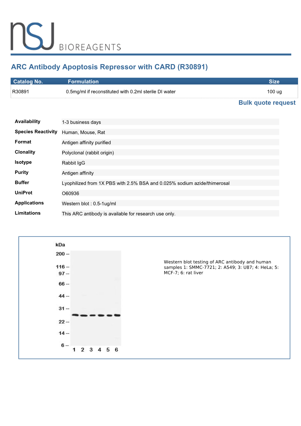 ARC Antibody Apoptosis Repressor with CARD (R30891)