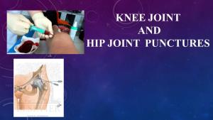 Knee Joint and Hip Joint Punctures Arthrocentesis As a Term