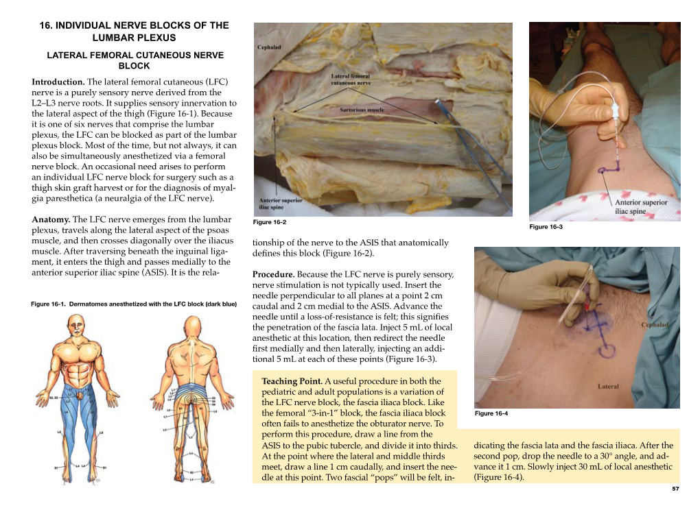 Chapter 16 – Individual Nerve Blocks of the Lumbar Plexus