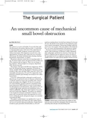 An Uncommon Cause of Mechanical Small Bowel Obstruction The