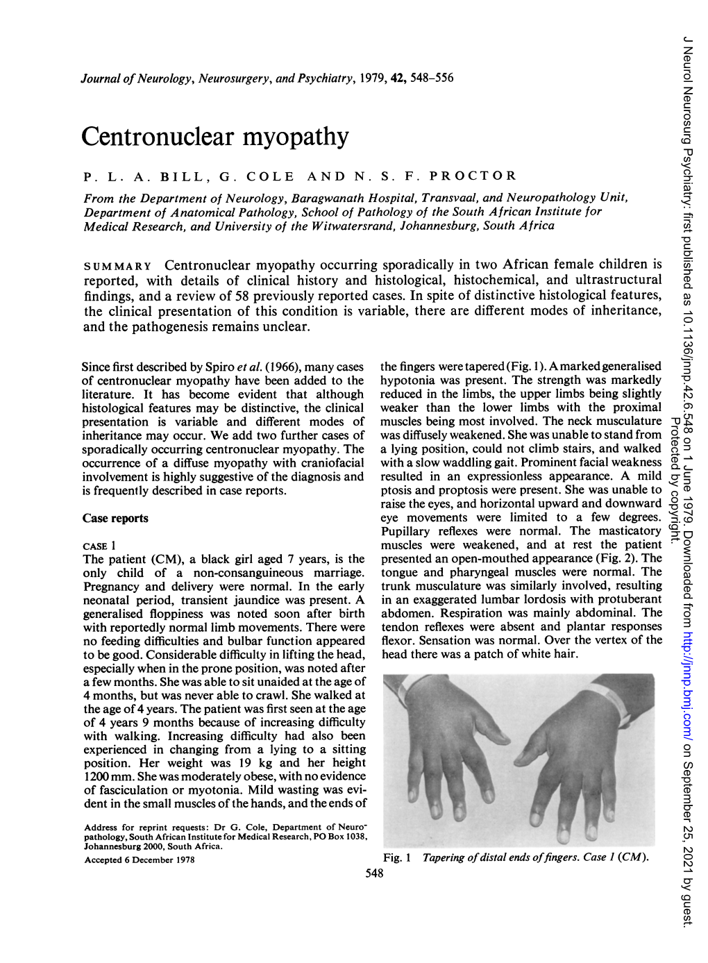 Centronuclear Myopathy