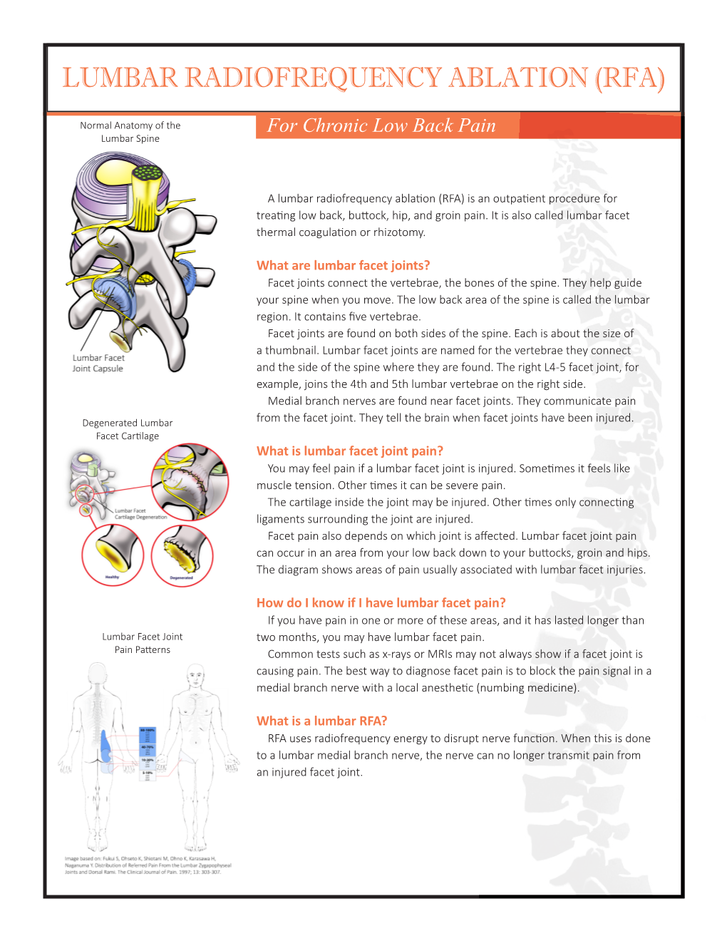 Lumbar Radiofrequency Ablation (Rfa)