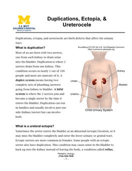 Duplications, Ectopia, & Ureterocele
