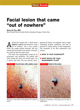Facial Lesion That Came “Out of Nowhere”