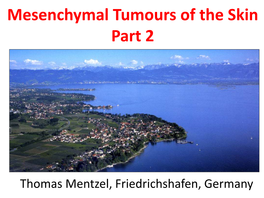 Mesenchymal Tumours of the Skin Part 2