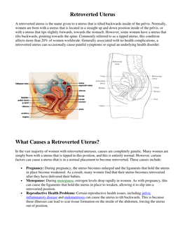 Retroverted Uterus What Causes a Retroverted Uterus?