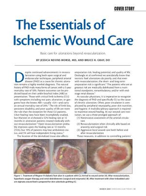 The Essentials of Ischemic Wound Care Basic Care for Ulcerations Beyond Revascularization