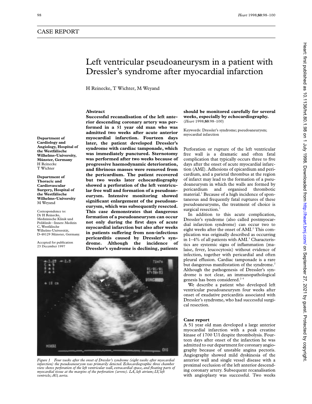 Left Ventricular Pseudoaneurysm in a Patient with Dressler's Syndrome