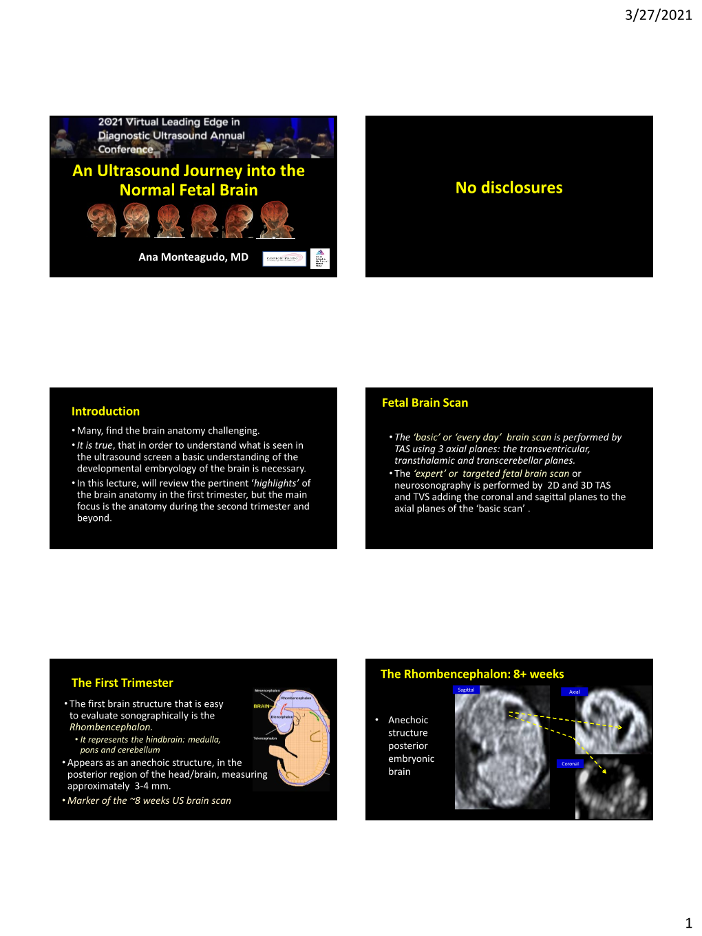 An Ultrasound Journey Into the Normal Fetal Brain No Disclosures