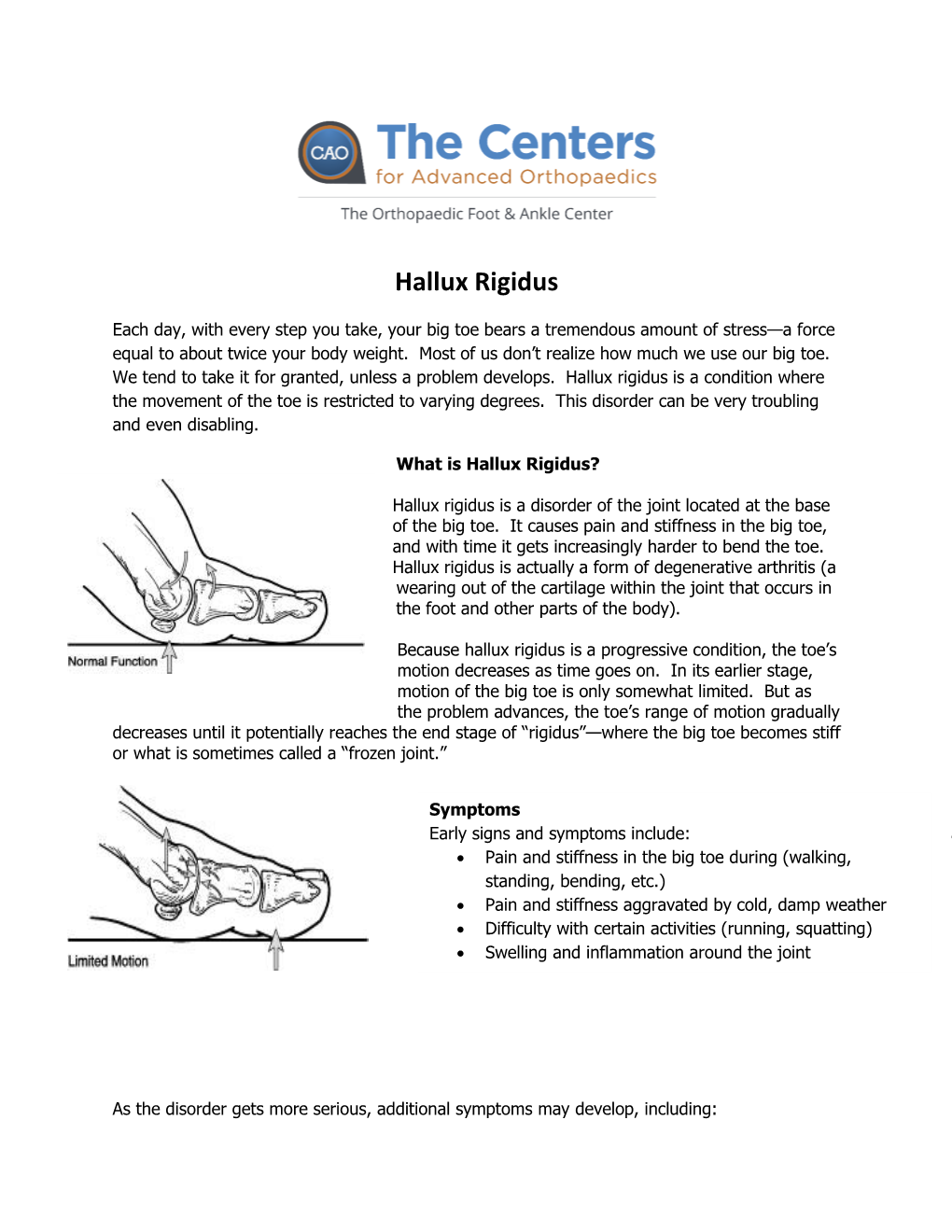 Hallux Rigidus