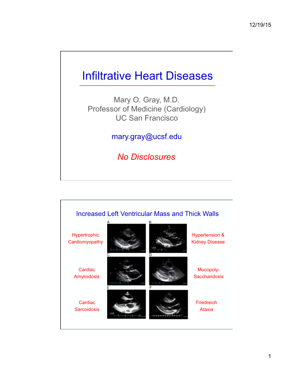 17 Gray Amyloidosis