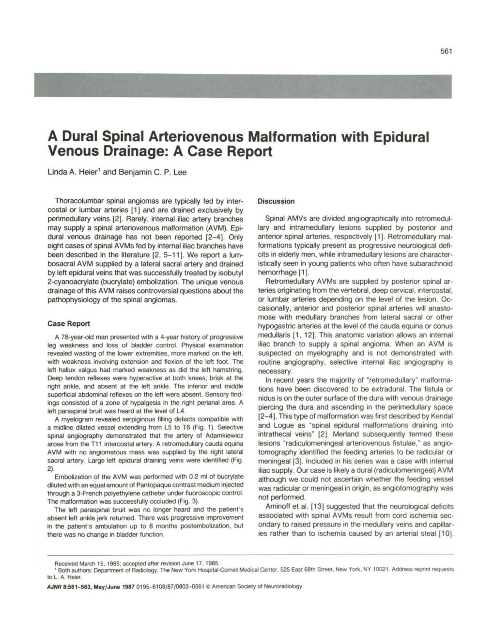 A Dural Spinal Arteriovenous Malformation with Epidural Venous Drainage: a Case Report