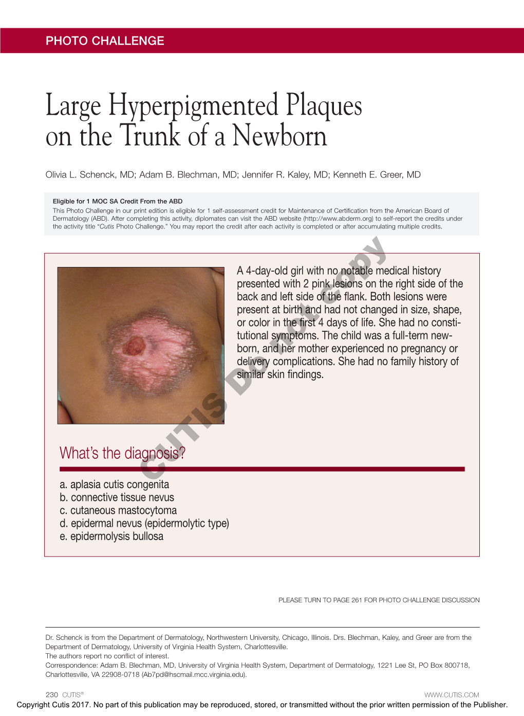 Large Hyperpigmented Plaques on the Trunk of a Newborn