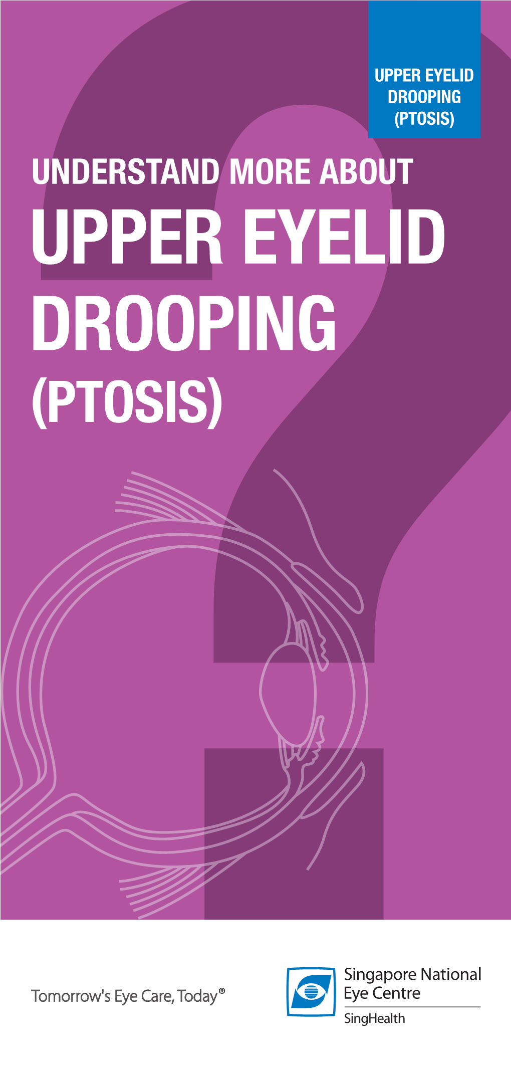 UPPER EYELID DROOPING (PTOSIS) UNDERSTAND MORE ABOUT UPPER EYELID DROOPING (PTOSIS) Upper Eyelid Drooping (Ptosis)