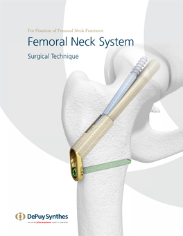 Femoral Neck System Surgical Technique Table of Contents