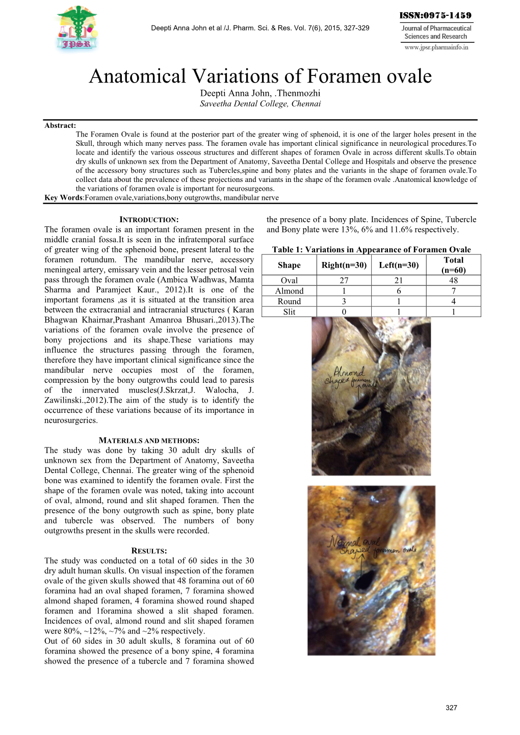 Anatomical Variations of Foramen Ovale Deepti Anna John, .Thenmozhi Saveetha Dental College, Chennai