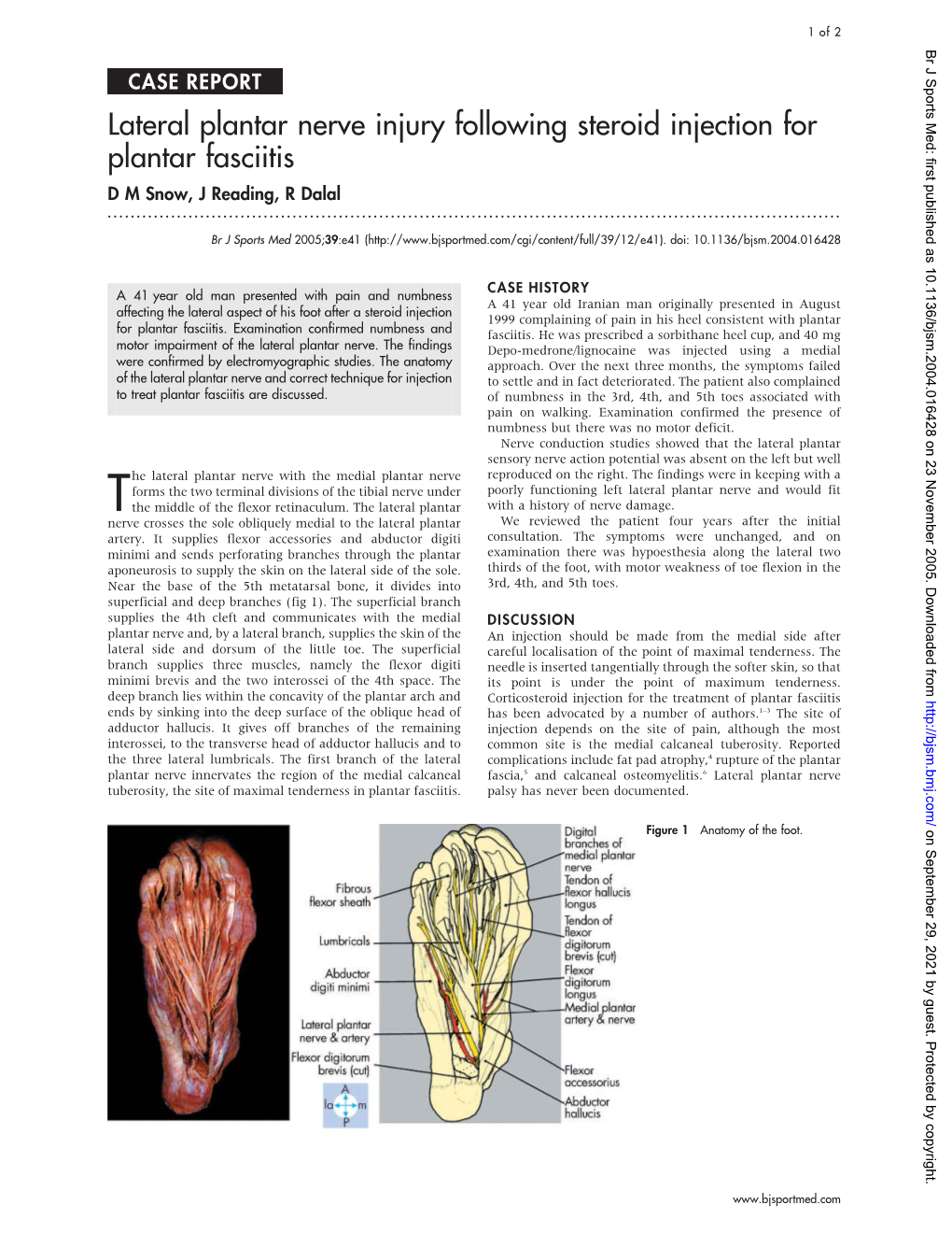 Lateral Plantar Nerve Injury Following Steroid Injection for Plantar Fasciitis D M Snow, J Reading, R Dalal