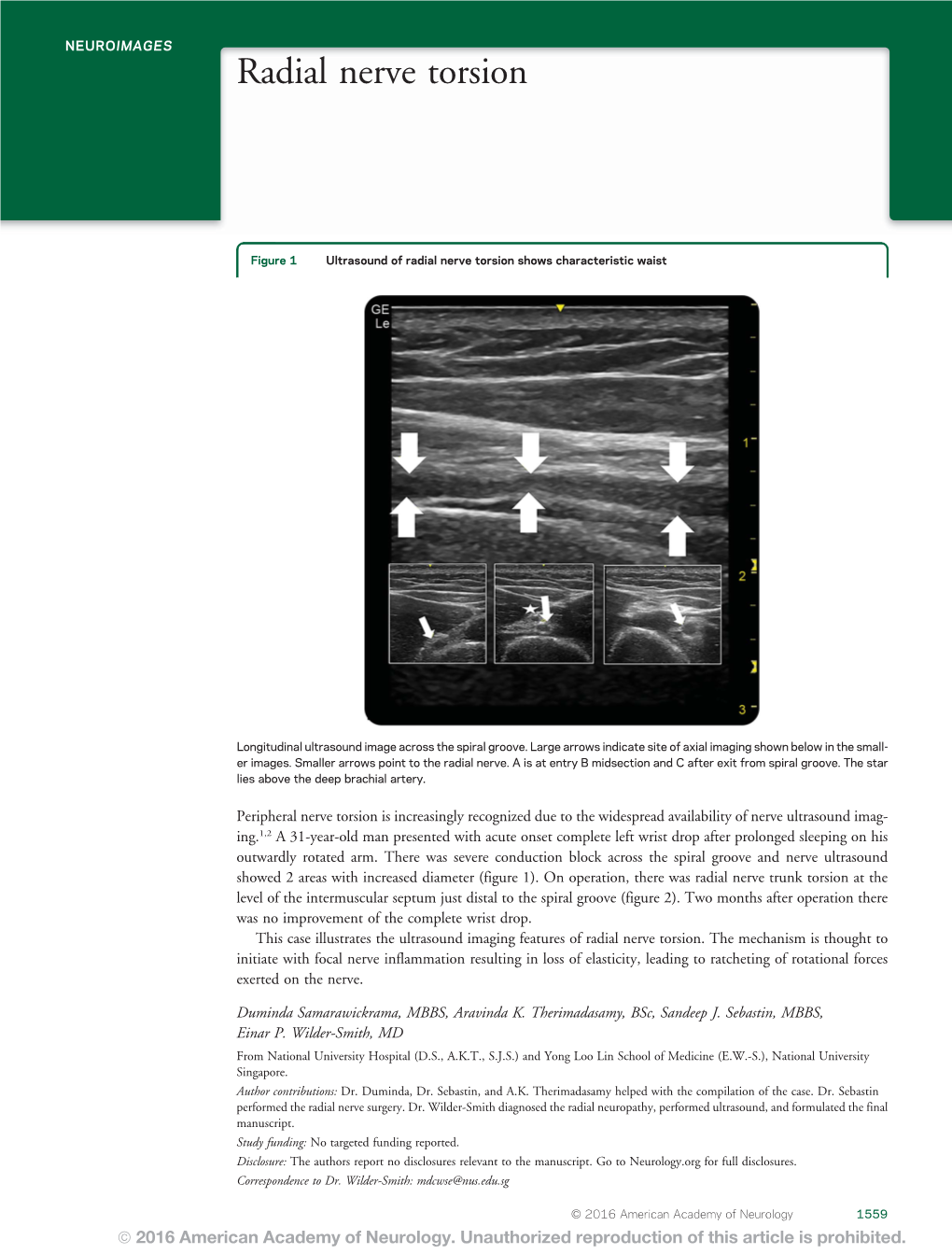 Radial Nerve Torsion