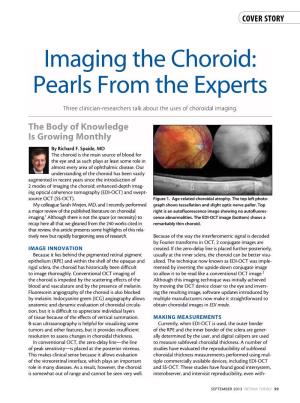 Imaging the Choroid: Pearls from the Experts