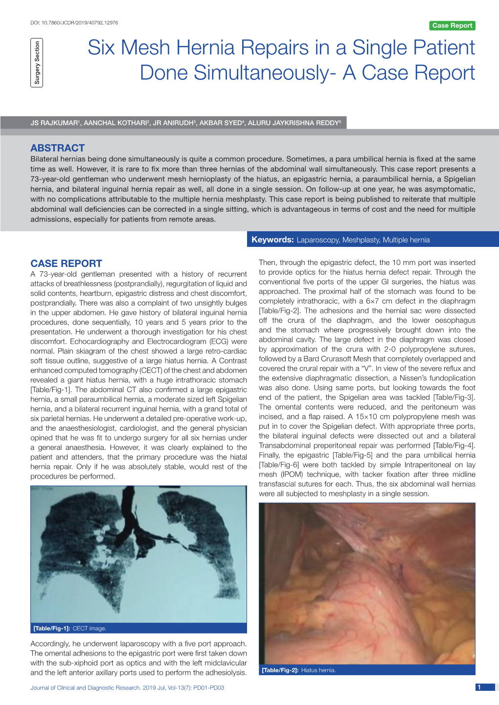 Six Mesh Hernia Repairs in a Single Patient Done Simultaneously