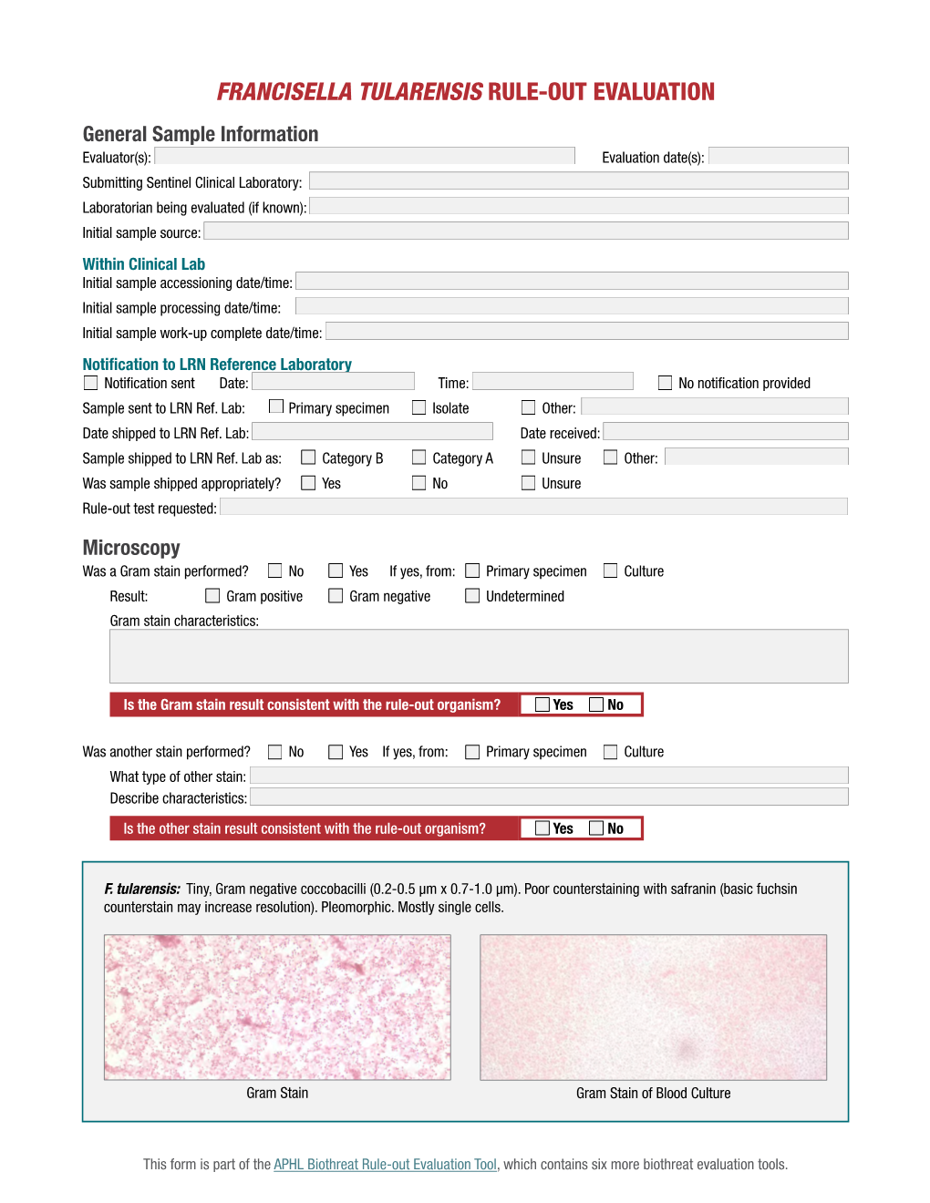 Francisella Tularensis Rule-Out Evaluation