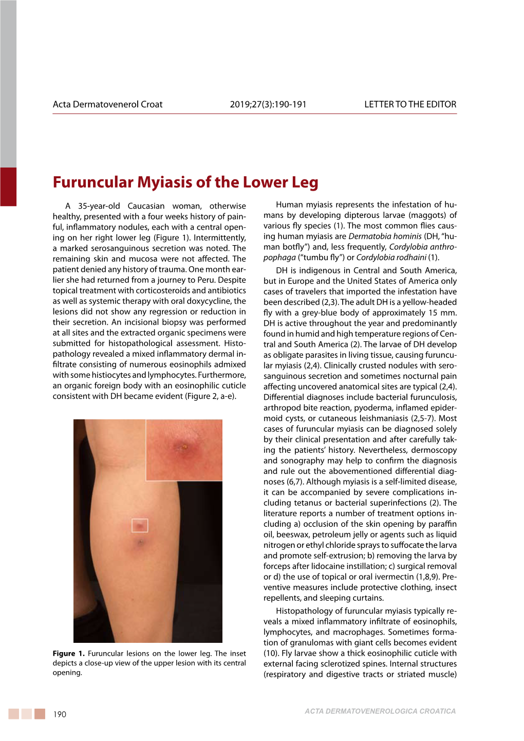 Furuncular Myiasis of the Lower Leg