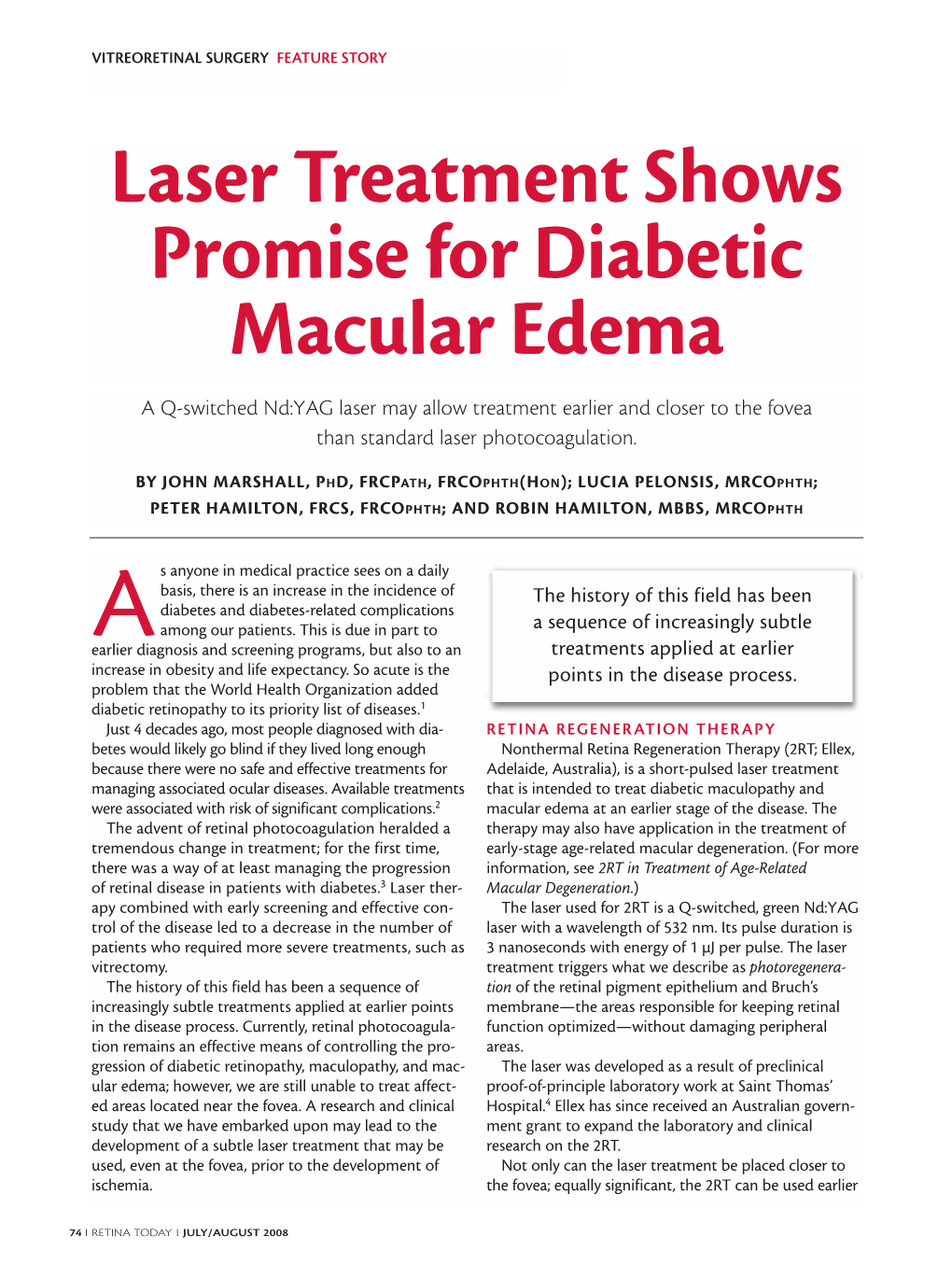 Laser Treatment Shows Promise for Diabetic Macular Edema