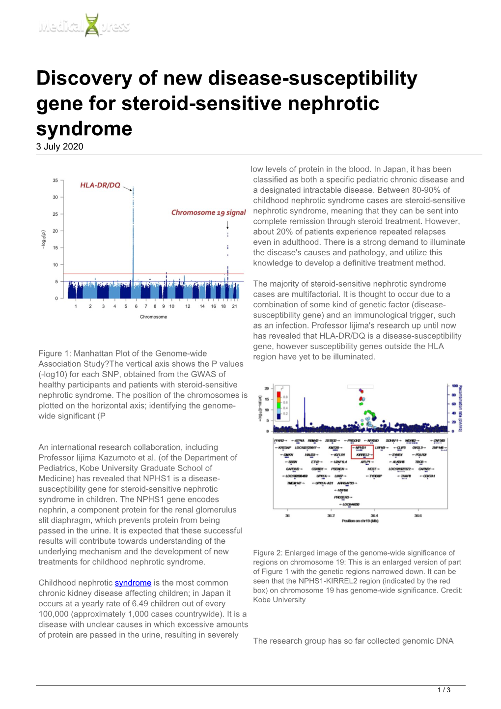 Discovery of New Disease-Susceptibility Gene for Steroid-Sensitive Nephrotic Syndrome 3 July 2020