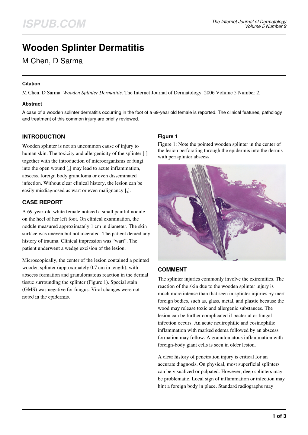 Wooden Splinter Dermatitis M Chen, D Sarma