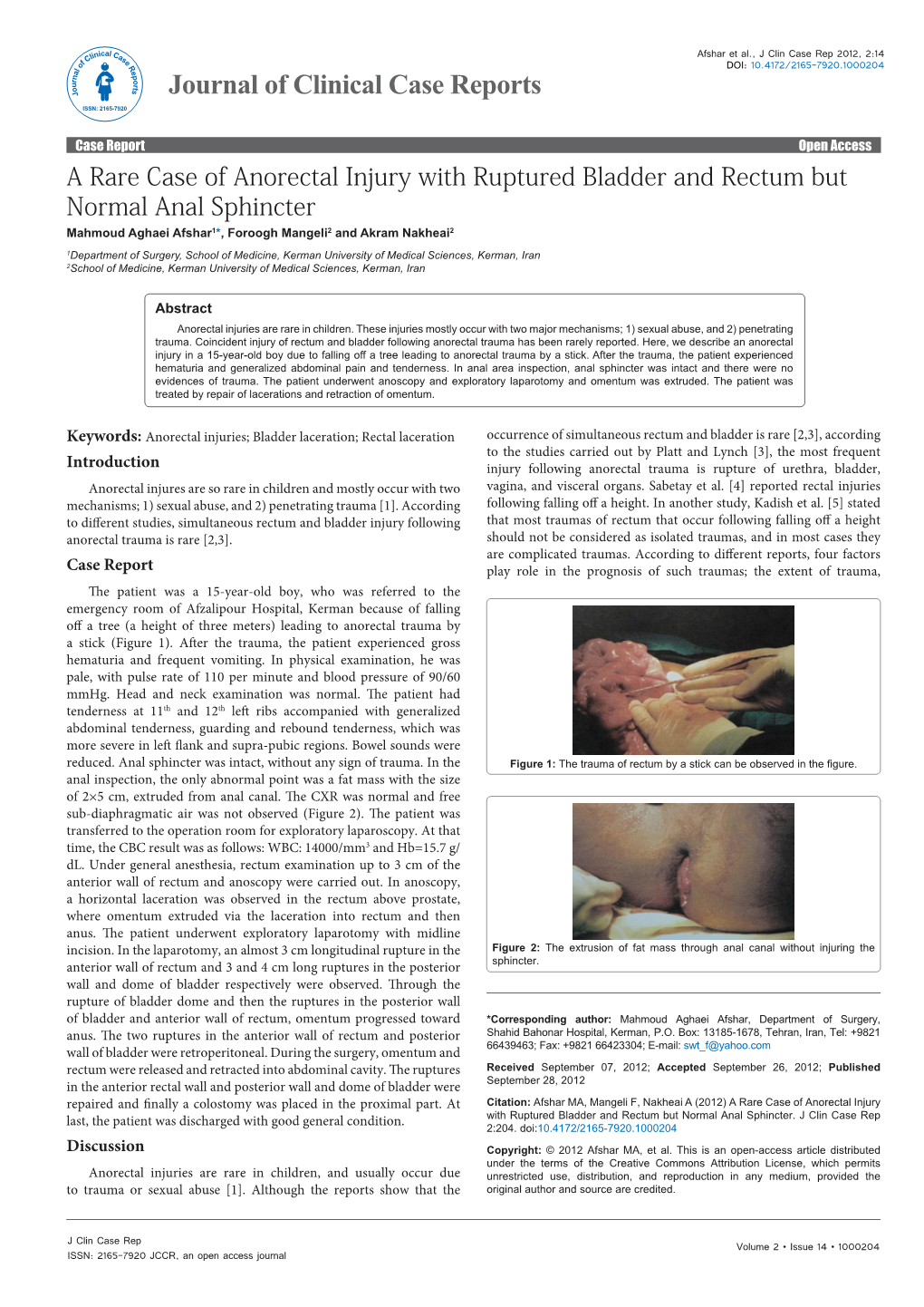 A Rare Case of Anorectal Injury with Ruptured Bladder and Rectum But